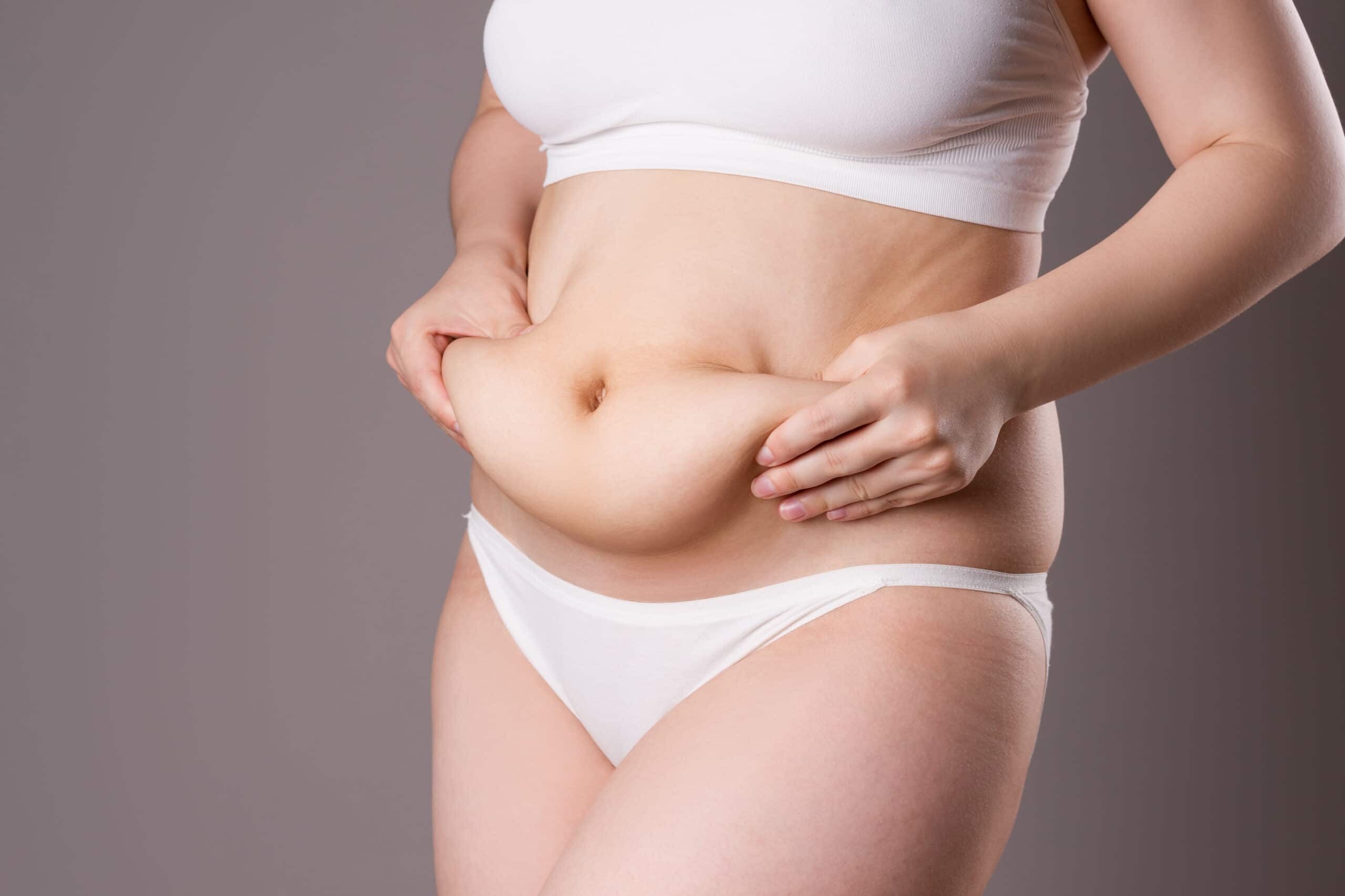 Tummy tuck, flabby skin on a fat belly, plastic surgery concept on gray background